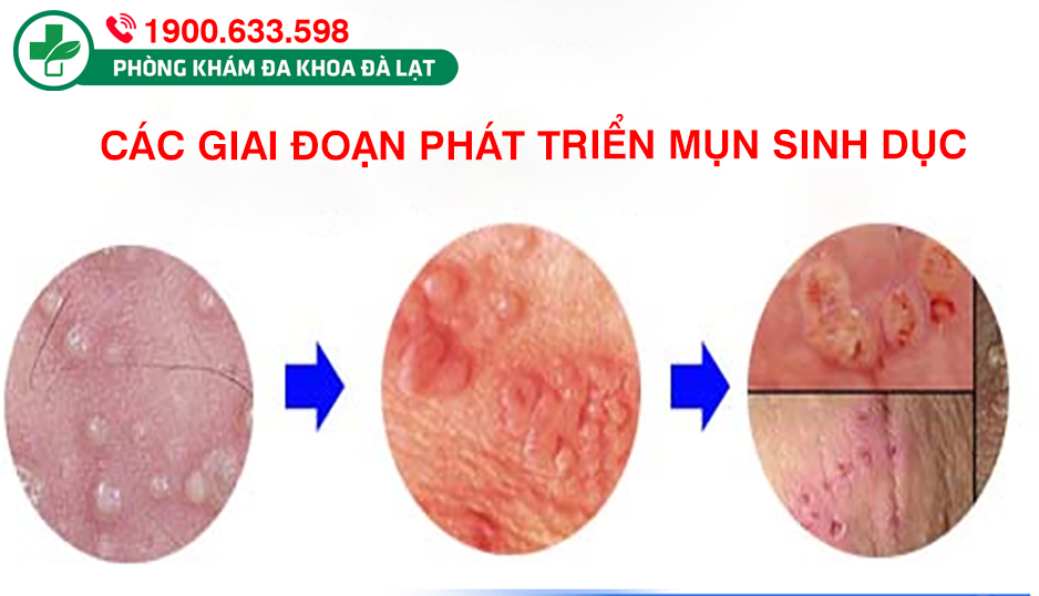 Hình ảnh minh họa